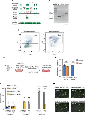 Histone H3K36me2-Specific Methyltransferase ASH1L Promotes MLL-AF9-Induced Leukemogenesis